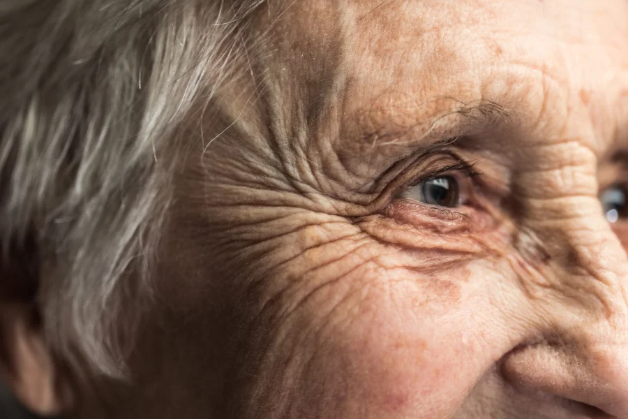 Older client's face close up